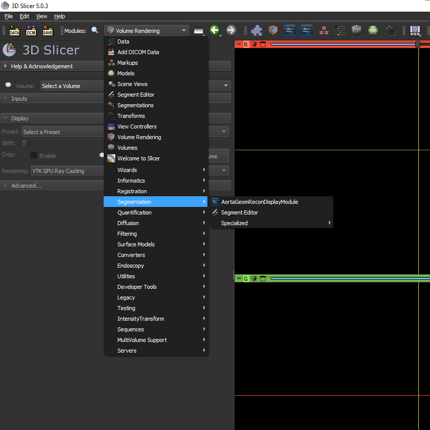 import AortaGeomRecon module