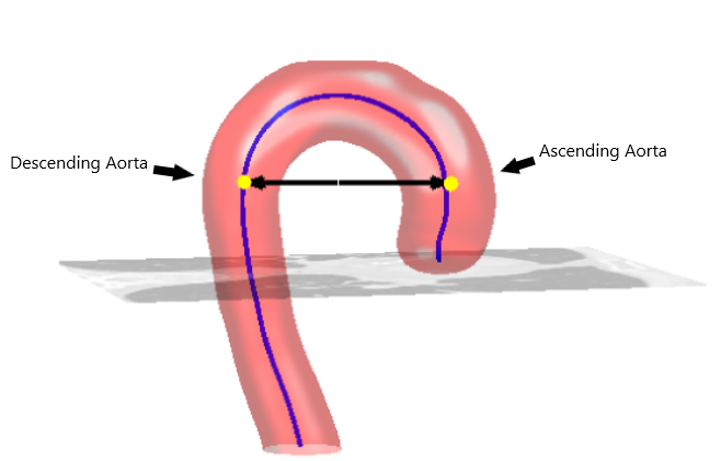 Aorta seeds