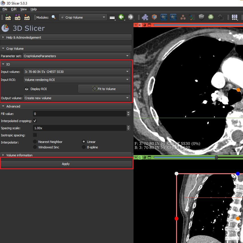 Selecting crop parameters, use ROI created by Volume Rendering and use the volume from DICOM patient file.