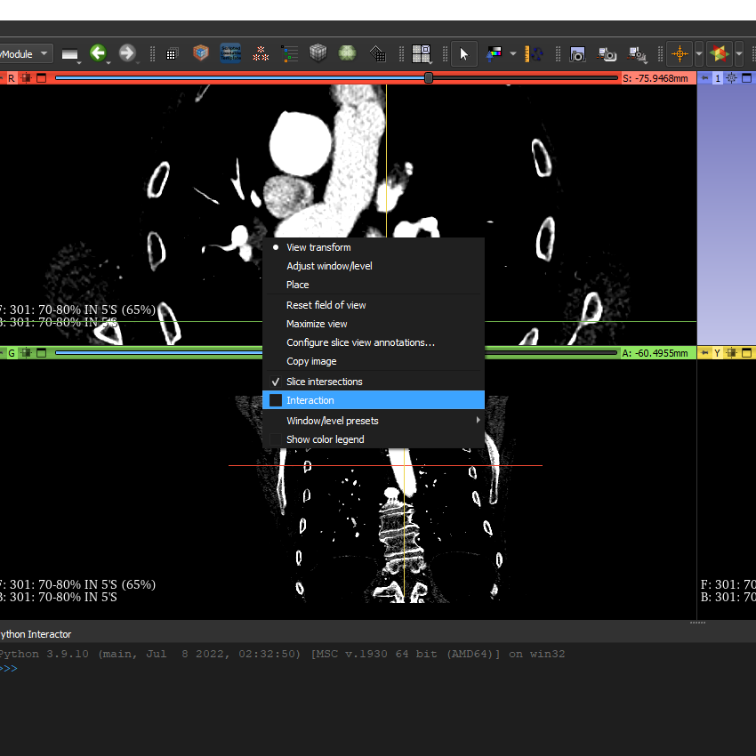 3D Slicer User Interface on Interaction