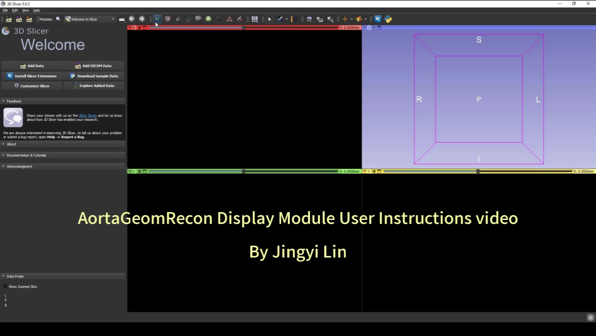 AortaGeomRecon Video instruction