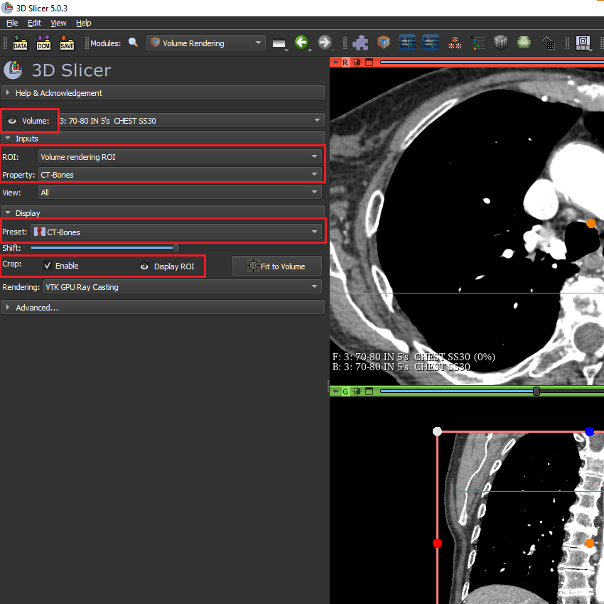 The Volume Rendering module UI